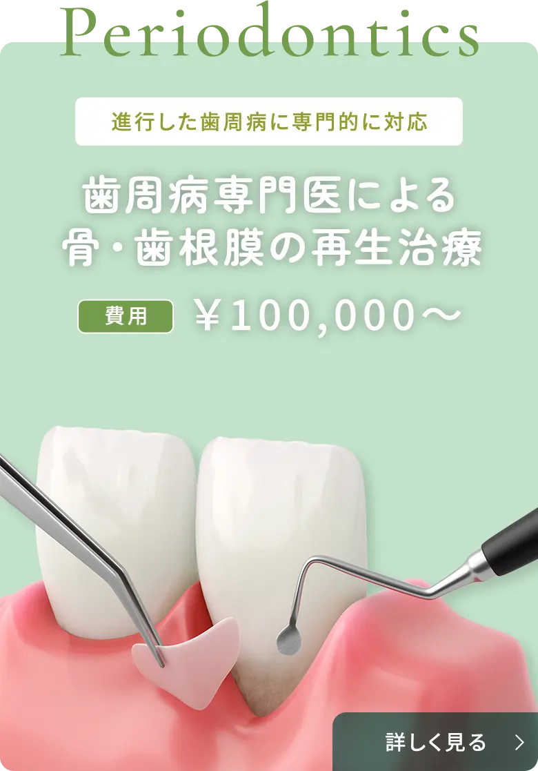 歯周病専門医による骨・歯根膜の再生療法