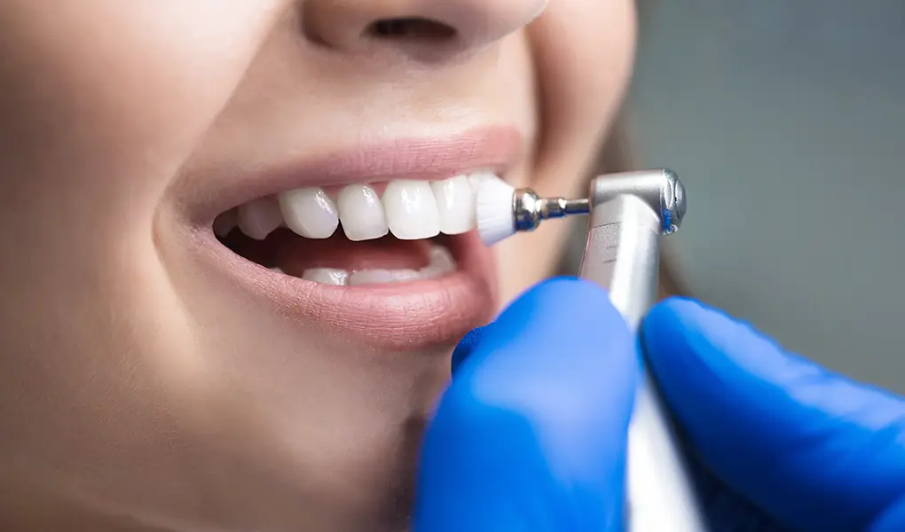 PMTC（Professional Mechanical Tooth Cleaning：専門家による機械的歯面清掃）